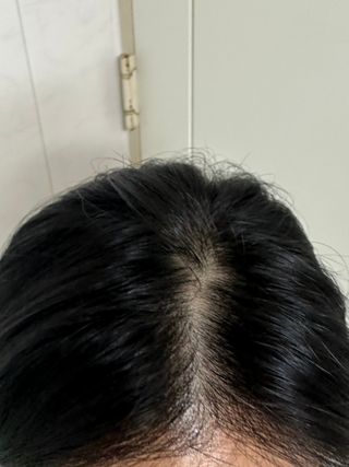 딸로 맥주효모 두피스케일러 / 각질&노폐물 타파 두피 딥-클렌징 — 5점을 준 리뷰어가 2023년 7월 올린 사용 사진