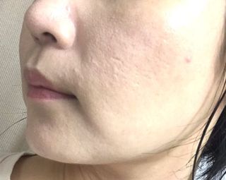 약손명가코스메틱 에오스보떼 블라인드 비비크림 50ml — 5점을 준 리뷰어가 2021년 9월 올린 사용 사진