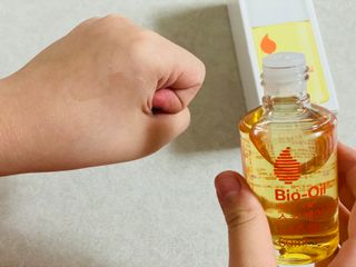 바이오오일 [바이오-오일] 스킨케어 오일 내추럴 60ml — 5점을 준 리뷰어가 2021년 11월 올린 사용 사진
