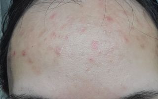 [트리마이] 피부 컨디션에 맞춰쓰는 솔루션 에센스토너 5종 — 5점을 준 리뷰어가 2023년 7월 올린 사용 사진