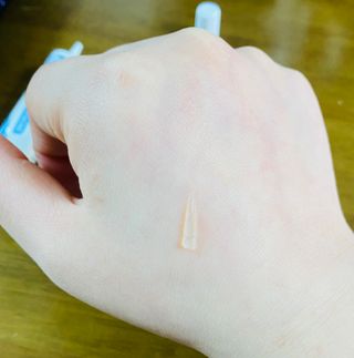 히루스카 포스트아크네 클리어 — 5점을 준 리뷰어가 2021년 1월 올린 사용 사진