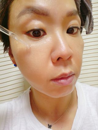 나나스킨 콤플렉스씨쓰리닥터클리어앰플 — 5점을 준 리뷰어가 2021년 10월 올린 사용 사진