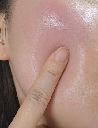 MF[스킨1004] 마다가스카르 센텔라 앰플 100ml — 5점을 준 리뷰어가 2024년 5월 올린 사용 사진
