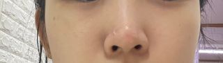 세뚜아(Cettua) 세뚜아 스팟 클리어 듀얼 패치 Cettua Spot Clear Dual Patch — 5점을 준 리뷰어가 2023년 10월 올린 사용 사진