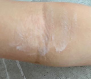 젠바이오 코스메틱스 젠바이오수딩크림]   가려운 피부 & 아토피 원픽 크림 — 5점을 준 리뷰어가 2022년 8월 올린 사용 사진