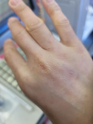 아이디플라코스메틱 아이디 페이스핏 플러스 앰플 — 5점을 준 리뷰어가 2022년 3월 올린 사용 사진