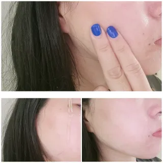 베지톨로지 비니페린 브라이트닝 앰플 — 5점을 준 리뷰어가 2022년 8월 올린 사용 사진
