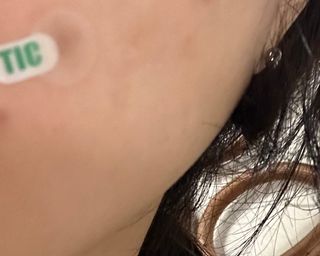 [큐어반H 스팟] 자외선 99프로 차단되는 스틱타입 스팟밴드(1팩 / 66매입) — 5점을 준 리뷰어가 2022년 11월 올린 사용 사진