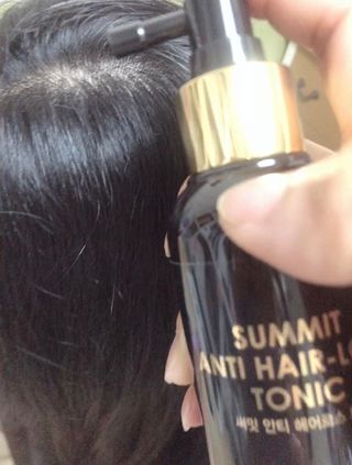 썸헤어 / SUMHAIR 썸헤어 써밋 안티 헤어로스 토닉 — 5점을 준 리뷰어가 2021년 5월 올린 사용 사진