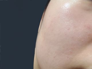 에스트라 아토베리어365 하이드로 수딩크림 — 5점을 준 리뷰어가 2022년 6월 올린 사용 사진