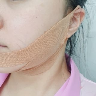 아이디플라코스메틱 아이디 페이스핏 마이너스 밴드 v2 — 5점을 준 리뷰어가 2021년 5월 올린 사용 사진