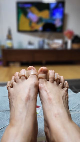 휜 발가락이 아프다면..발가락 스트레칭 보조용품 쿨핀 두발애(1set-2개입) — 4점을 준 리뷰어가 2022년 6월 올린 사용 사진