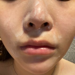 메데스 비츠케어 모공케어 피부관리키트 — 5점을 준 리뷰어가 2021년 7월 올린 사용 사진