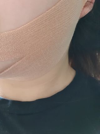 아이디플라코스메틱 아이디 페이스핏 마이너스 밴드 v2 — 5점을 준 리뷰어가 2020년 12월 올린 사용 사진