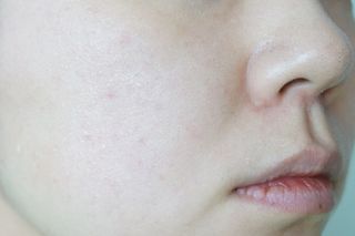 셀바이져 지우개 미스트 피부 보호 입주변 트러블 진정 케어 아기 안개분사 미스트 — 5점을 준 리뷰어가 2021년 2월 올린 사용 사진