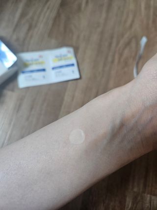 3M 넥스케어 블레미쉬 여드름패치 릴리프 111매(짜기 전 케어) +알코올스왑 증정 — 5점을 준 리뷰어가 2024년 5월 올린 사용 사진