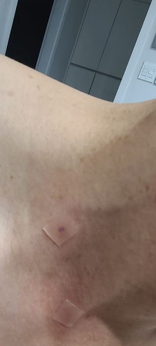 [큐어반H 커팅] 간편하게 떼서 쓰는 자외선차단 습윤밴드 (1팩/30매입) — 5점을 준 리뷰어가 2022년 10월 올린 사용 사진