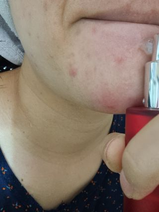 레드투래드 센서티브 어메이징 앰플 30ml — 5점을 준 리뷰어가 2021년 10월 올린 사용 사진