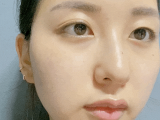 체르엠 스템앤셀 비타민 브라이트닝 에센스 30ml 1개 — 5점을 준 리뷰어가 2021년 9월 올린 사용 사진