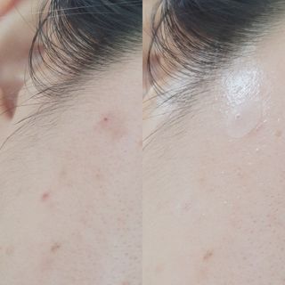 세뚜아(Cettua) 세뚜아 스팟 클리어 듀얼 패치 Cettua Spot Clear Dual Patch — 4.5점을 준 리뷰어가 2023년 6월 올린 사용 사진