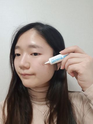 히루스카 포스트아크네 클리어 — 5점을 준 리뷰어가 2021년 2월 올린 사용 사진