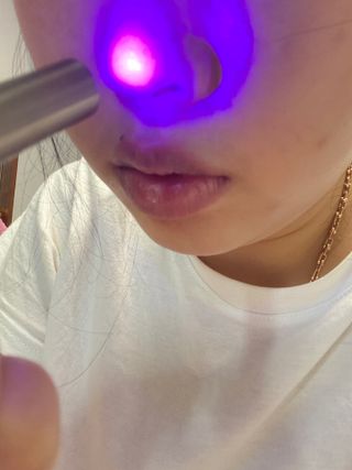 메데스 비츠케어 모공케어 피부관리키트 — 3.5점을 준 리뷰어가 2021년 8월 올린 사용 사진