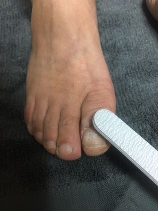 유케어 YOU CARE 문제성 손발톱케어_럭키풋 — 5점을 준 리뷰어가 2022년 10월 올린 사용 사진