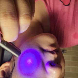 메데스 비츠케어 모공케어 피부관리키트 — 5점을 준 리뷰어가 2021년 7월 올린 사용 사진