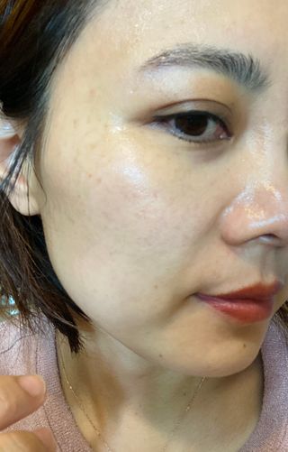 체르엠 스템앤셀 비타민 브라이트닝 에센스 30ml 1개 — 3.5점을 준 리뷰어가 2021년 10월 올린 사용 사진