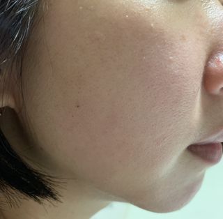 브에노 스킨셀 더마 앰플 — 3점을 준 리뷰어가 2021년 7월 올린 사용 사진
