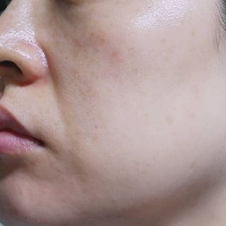 바이리뮤 에이지 홀딩 펩타톡스 앰플 — 5점을 준 리뷰어가 2021년 3월 올린 사용 사진