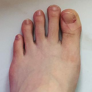 [큐어반H 커팅] 간편하게 떼서 쓰는 자외선차단 습윤밴드 (1팩/30매입) — 4.5점을 준 리뷰어가 2022년 11월 올린 사용 사진