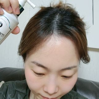 모두발라 탈모집중케어 헤어토닉 — 5점을 준 리뷰어가 2022년 1월 올린 사용 사진