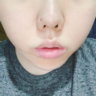 아이디플라코스메틱 아이디 페이스핏 마이너스 밴드 v2 — 5점을 준 리뷰어가 2021년 6월 올린 사용 사진