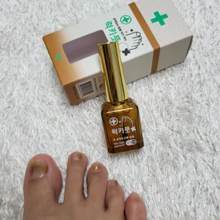 유케어 YOU CARE 문제성 손발톱케어_럭키풋 — 5점을 준 리뷰어가 2022년 10월 올린 사용 사진