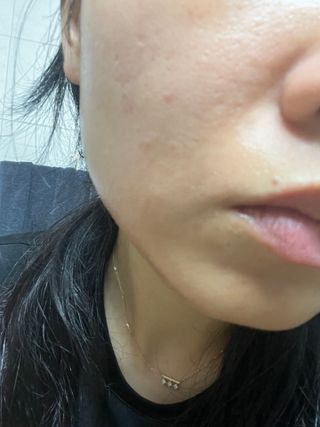 스킨1004 [SKIN1004] 마다가스카르 센텔라 라이트 클렌징 오일 200ml — 5점을 준 리뷰어가 2024년 8월 올린 사용 사진