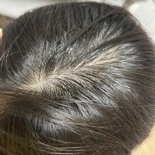달리프 클로렐라 베러 루트 쿨링 스프레이 100ml — 4점을 준 리뷰어가 2021년 5월 올린 사용 사진