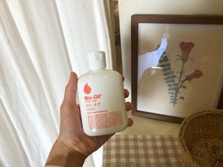 바이오오일 [바이오-오일] 바디 로션 175ml — 5점을 준 리뷰어가 2021년 10월 올린 사용 사진