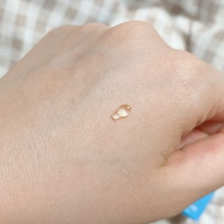 히루스카 포스트아크네 클리어 — 5점을 준 리뷰어가 2021년 3월 올린 사용 사진