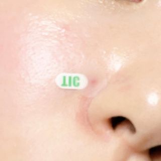 [큐어반H 스팟] 자외선 99프로 차단되는 스틱타입 스팟밴드(1팩 / 66매입) — 5점을 준 리뷰어가 2022년 11월 올린 사용 사진
