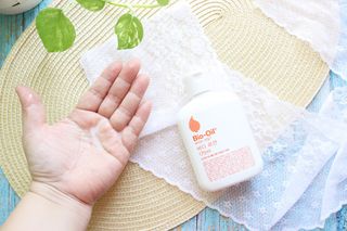 바이오오일 [바이오-오일] 바디 로션 175ml — 5점을 준 리뷰어가 2021년 10월 올린 사용 사진