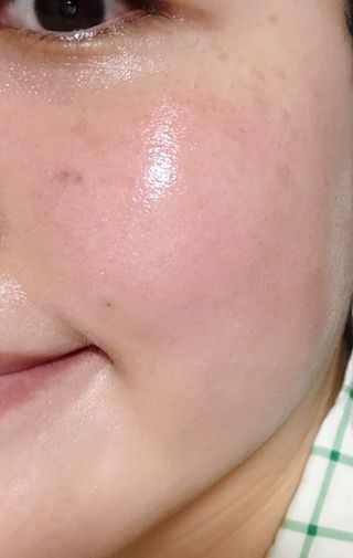 MF[스킨1004] 마다가스카르 센텔라 앰플 100ml — 5점을 준 리뷰어가 2024년 5월 올린 사용 사진