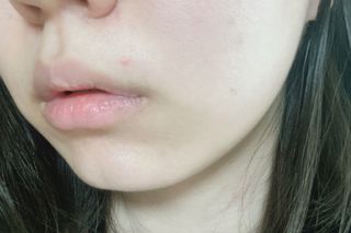 마이디플러스 트리플부스팅, 트러블 릴리프 케어 마이크로 패치 2종 중 택1 — 5점을 준 리뷰어가 2021년 11월 올린 사용 사진