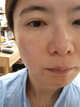 [스킨1004] 마다가스카르 센텔라 앰플 100ml — 5점을 준 리뷰어가 2024년 5월 올린 사용 사진