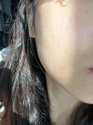오투에니원 갈락토미세스 리바이탈라이징 프리미엄 화이트닝 에센스 50ml — 5점을 준 리뷰어가 2022년 12월 올린 사용 사진