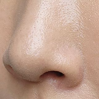세뚜아(Cettua) 세뚜아 스티키 포어 패치 Cettua Sticky Pore Patch — 4.5점을 준 리뷰어가 2023년 8월 올린 사용 사진
