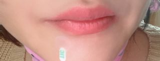 [큐어반H 스팟] 자외선 99프로 차단되는 스틱타입 스팟밴드(1팩 / 66매입) — 5점을 준 리뷰어가 2023년 1월 올린 사용 사진