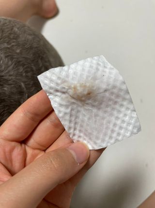 버츠비 케어플러스 릴리빙 이어린스 — 5점을 준 리뷰어가 2021년 6월 올린 사용 사진