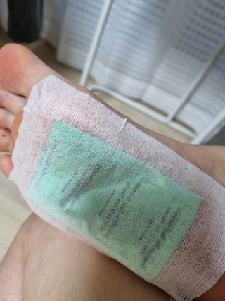 [레제르] 아로마 수액패치 발패치 30매입 -라벤더향/유칼립투스향/대나무향 — 5점을 준 리뷰어가 2022년 5월 올린 사용 사진