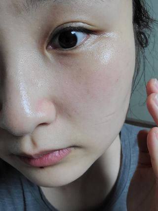 나나스킨 콤플렉스씨쓰리닥터클리어앰플 — 4.5점을 준 리뷰어가 2021년 6월 올린 사용 사진